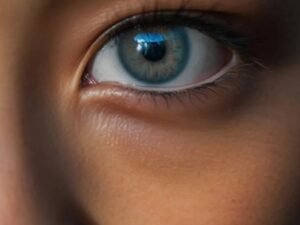 Eye Fillers South Delhi