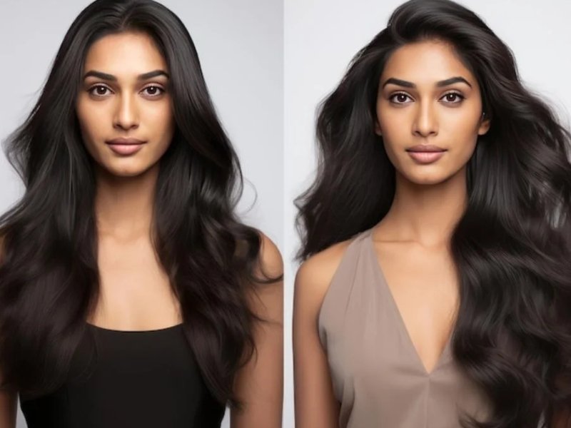 Hair PRP Treatment in Delhi