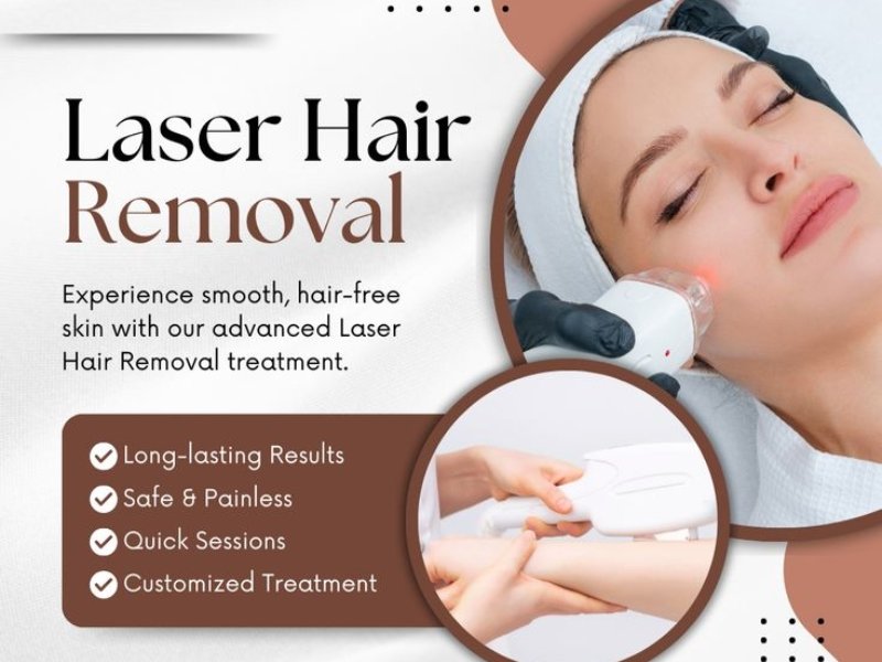 laser hair removal delhi