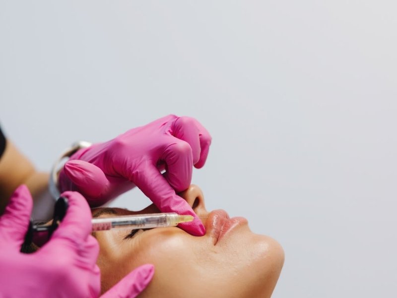 Fillers Treatment Delhi | Dermedico Clinic