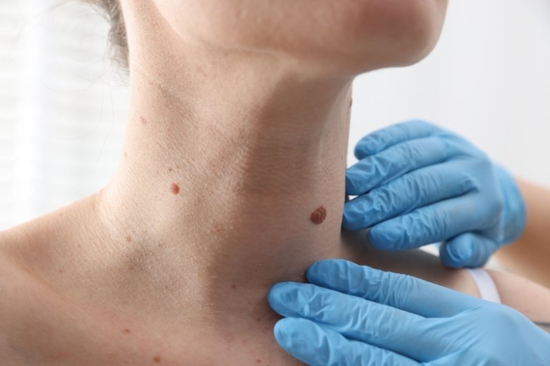 Near Me Skin Specialist Doctor in Delhi