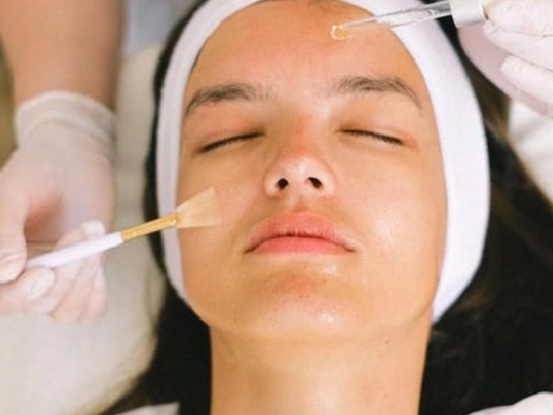Chemical Peel Treatment in Delhi