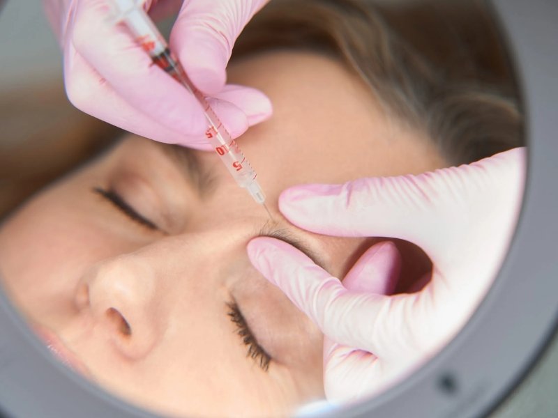 Botox Treatment in Delhi for Smooth Skin