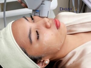 hifu treatment in delhi for skin tightening and non surgical face lift