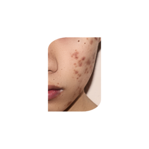 Best Dermatologist in Lajpat Nagar